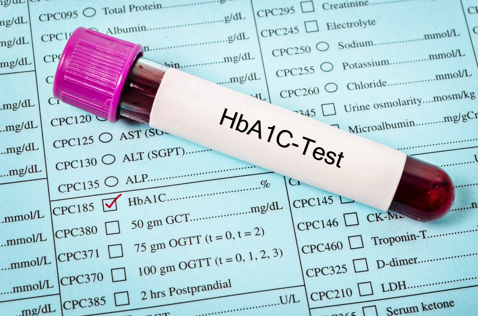 Know Your Hemoglobin A1c Numbers Diabetes 6295